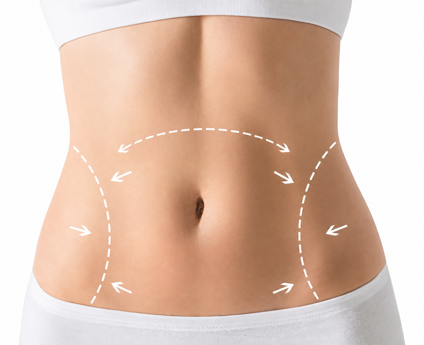 Cirugía abdominal